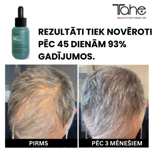 Matu izkrišanu mazinošs un augšanu stimulējošs koncentrāts Peptide T98 TAHE, 50 ml - Image 4